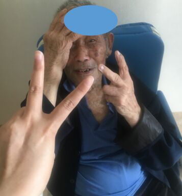 金堂一医院：94岁高龄白内障患者重见光明